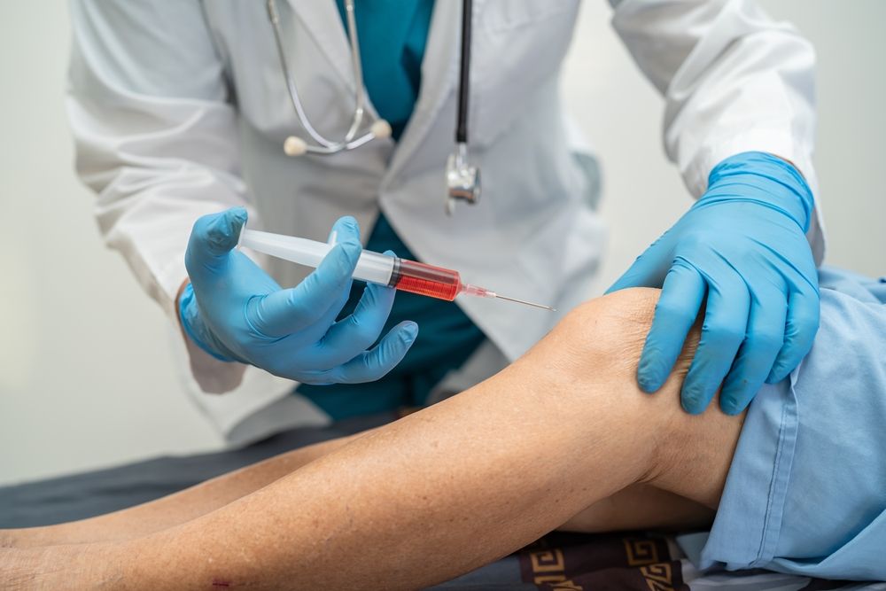 What You Need to Know About Arthritis Injections