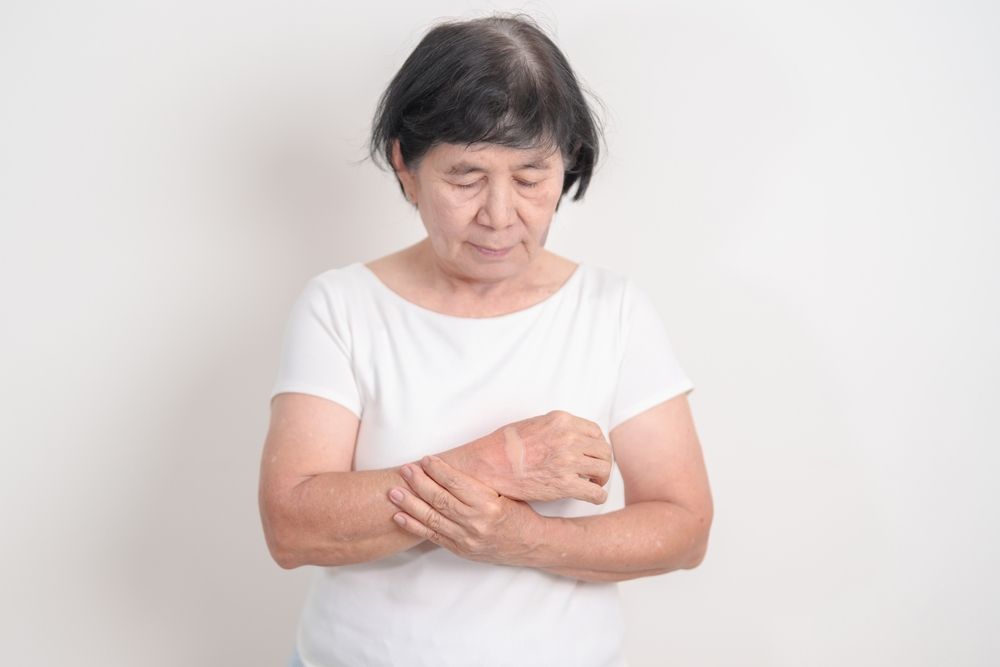Managing Hand Osteoarthritis: Approaches and Insights